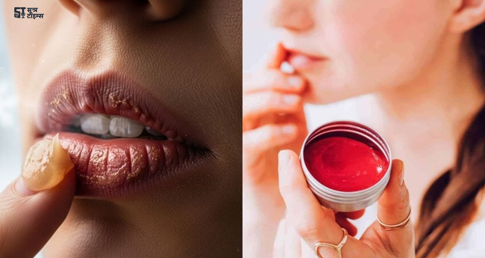 Winter Special DIY Lip Balm